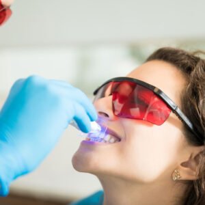 Teeth Whitening
